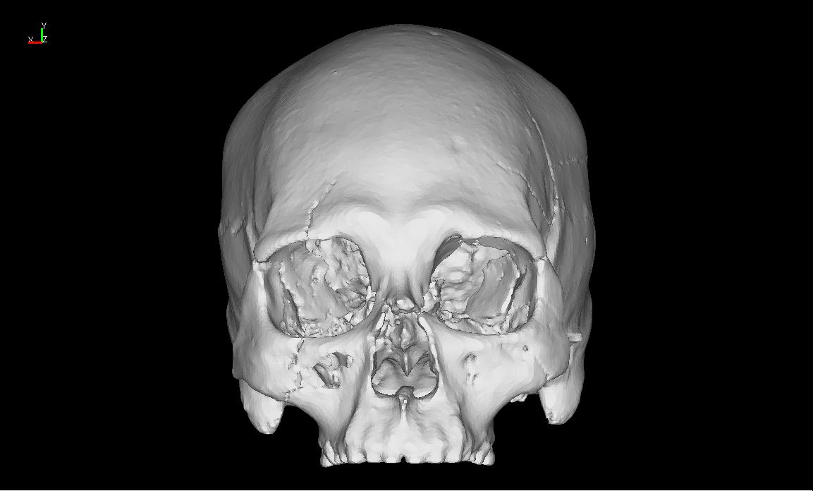 Digital Skull